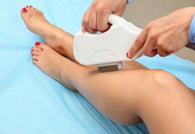 IPL -Hair Removal