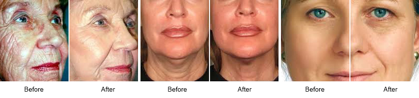 Advanced & Organic Facial Treatments