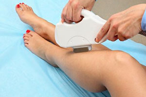day spa IPL hair removal